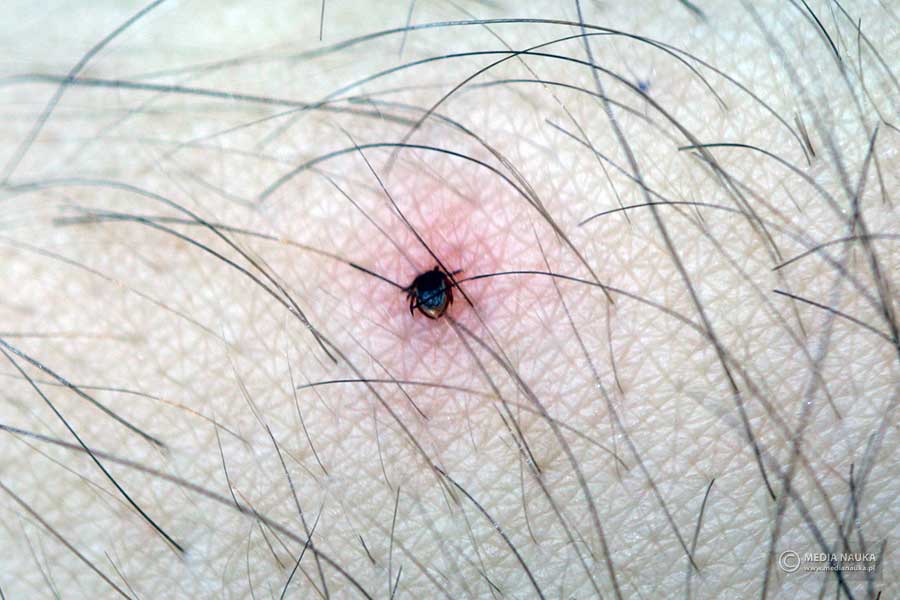 kleszcz pastwiskowy, kleszcz pospolity (Ixodes ricinus)