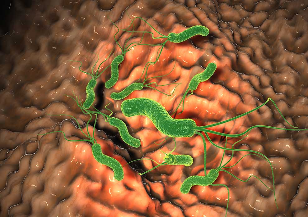 Helicobacter pylori © Axel Kock - stock.adobe.com