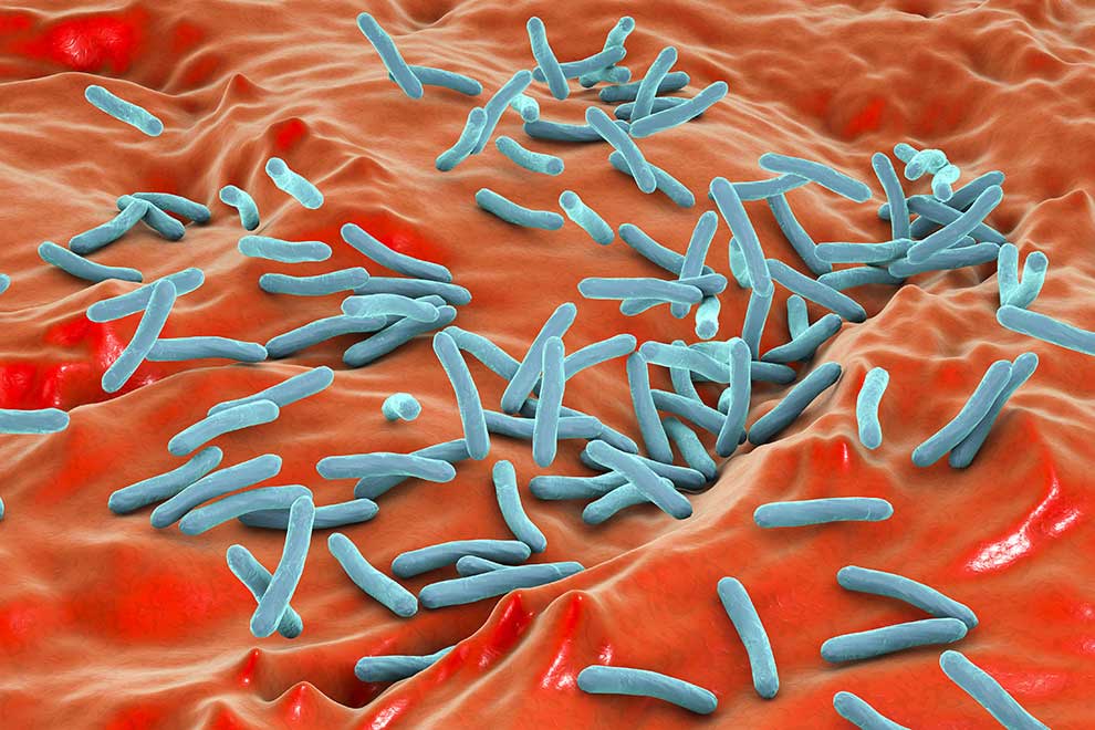 Prątek gruźlicy (Mycobacterium tuberculosis) © Kateryna_Kon - stock.adobe.com