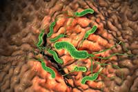 Helicobacter pylori