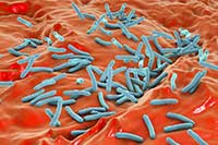 Mycobacterium tuberculosis