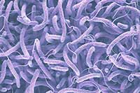 Vibrio cholerae