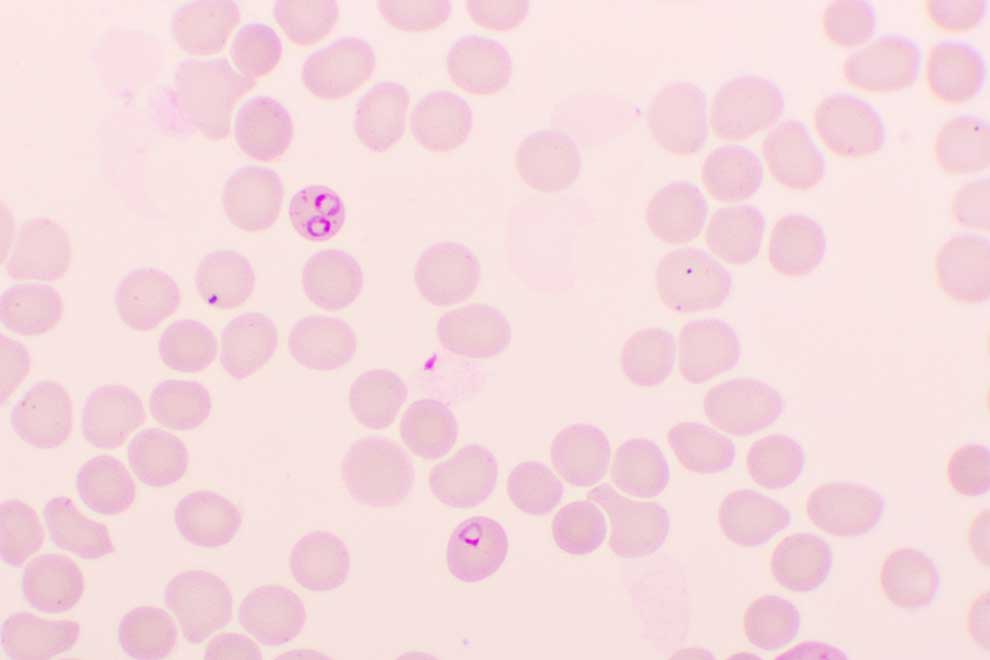 Zarodziec malarii - Acantharea